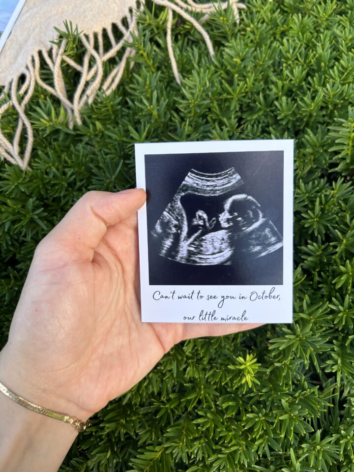 Pregnancy Photo Magnets